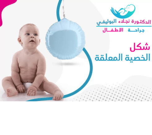 شكل الخصية المعلقة