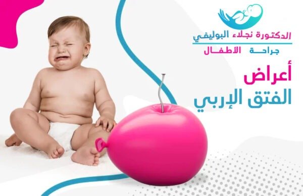 أعراض الفتق الإربي