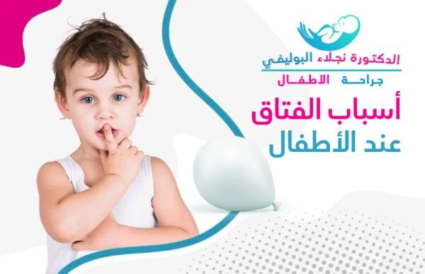 اسباب الفتاق عند الأطفال