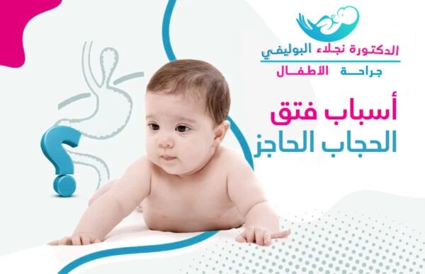 اسباب فتق الحجاب الحاجز