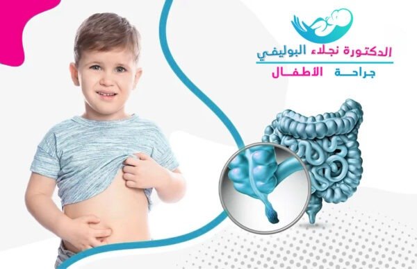 اضرار ازالة الزائدة الدودية