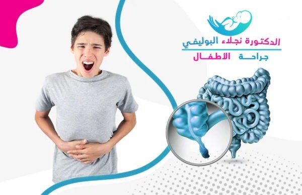 اعراض التهاب الزائدة الدودية عند الاطفال