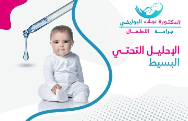 الاحليل التحتي البسيط