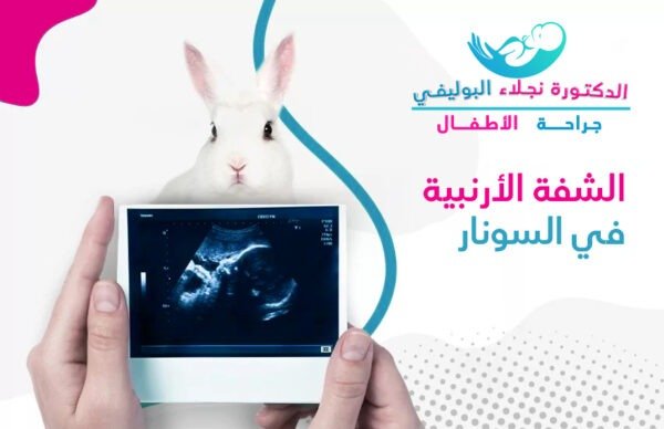 الشفة الأرنبية في السونار