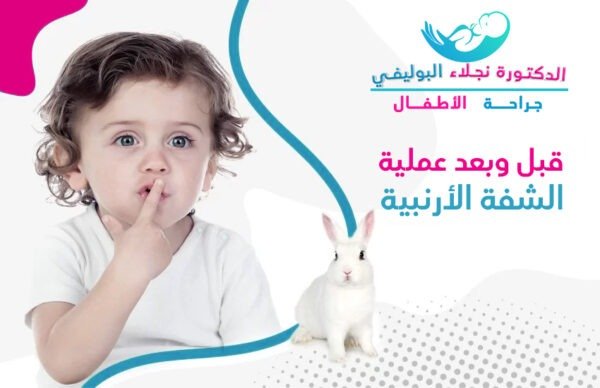 الشفة الأرنبية قبل وبعد العملية