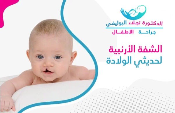 الشفة الأرنبية لحديثي الولادة