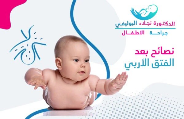اهم نصائح بعد عملية الفتق الاربي للاطفال