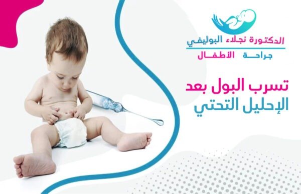 تسرب البول بعد عملية الإحليل التحتي