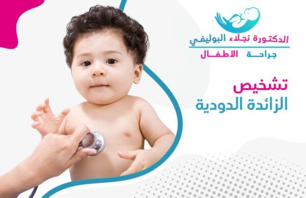 تشخيص الزائدة الدودية