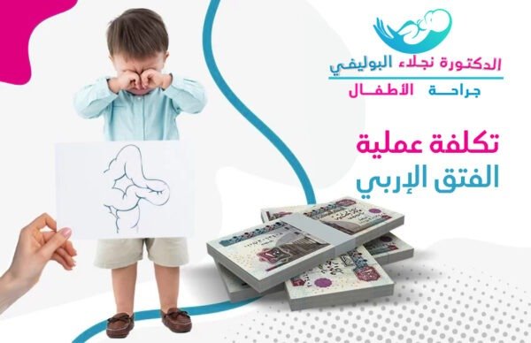 تكلفة عملية الفتق الاربى عند الأطفال