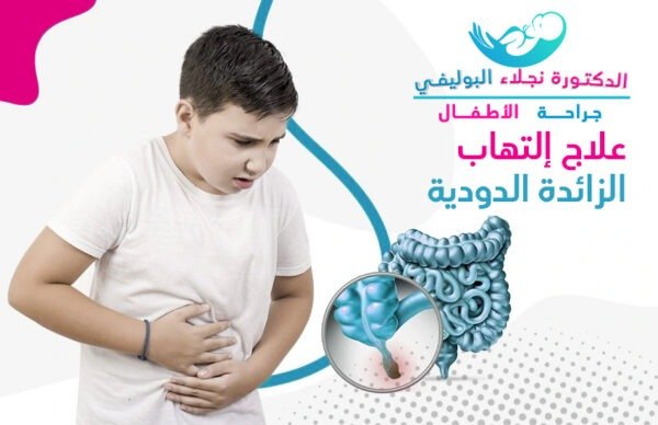 علاج التهاب الزائدة الدودية عند الأطفال