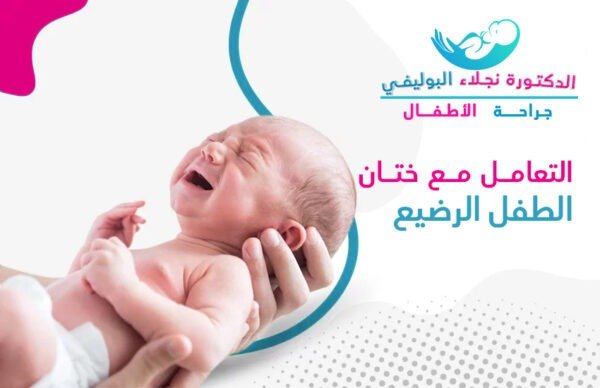 كيفية التعامل مع ختان الطفل الرضيع