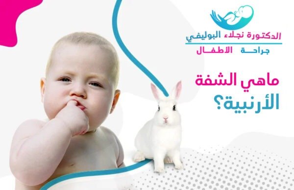 ماهي الشفه الارنبيه