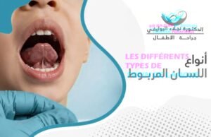 أنواع اللسان المربوط عند الأطفال وأعراضه وعلاجه