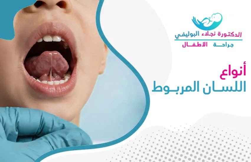 أنواع اللسان المربوط عند الأطفال وأعراضه وعلاجه