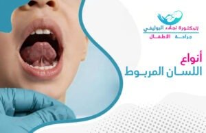 أنواع اللسان المربوط عند الأطفال: الأعراض والعلاج