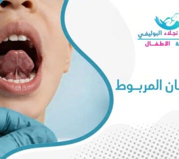 أنواع اللسان المربوط عند الأطفال: الأعراض والعلاج