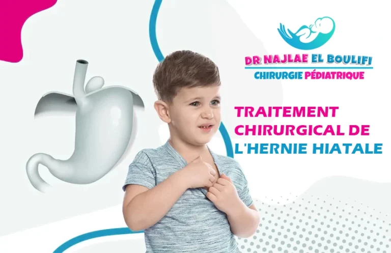 traitement chirurgical de l'hernie hiatale