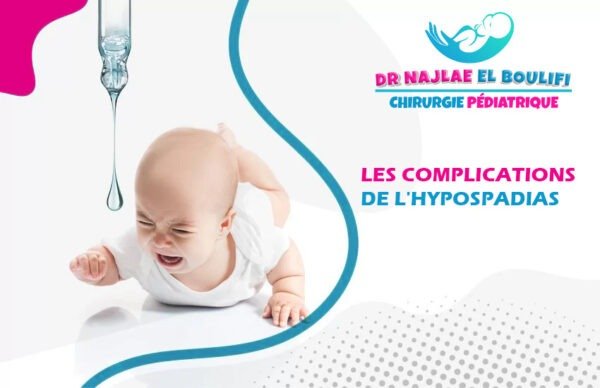 Complications de l'hypospadias