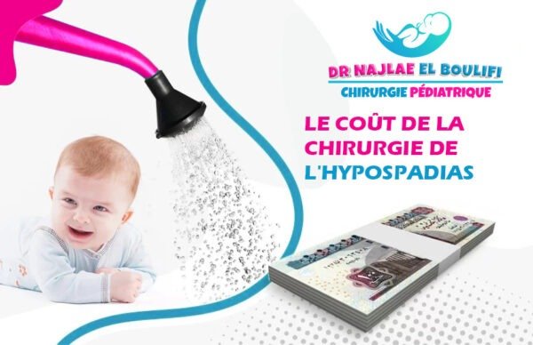 Coût de la Chirurgie de l'hypospadias