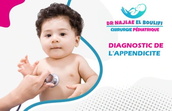 Diagnostic d'appendicite