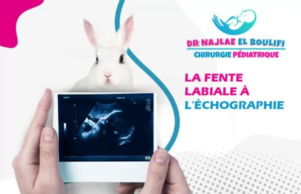 Fente labiale à l'échographie