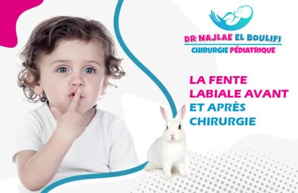 Fente labiale avant et après chirurgie