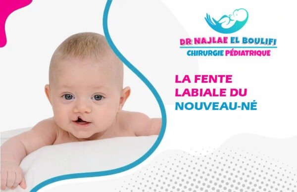 Fente labiale du nouveau-né