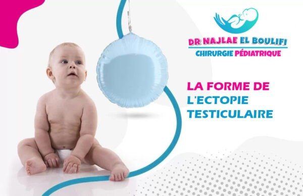 La forme de l'ectopie testiculaire