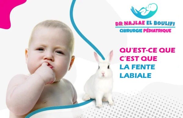 Qu'est-ce que c'est que la fente labiale