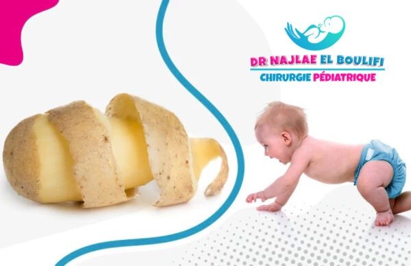le coût de le circoncision