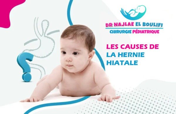 les Causes de la hernie hiatale