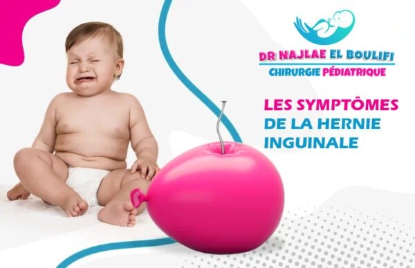 les Symptômes de la hernie inguinale
