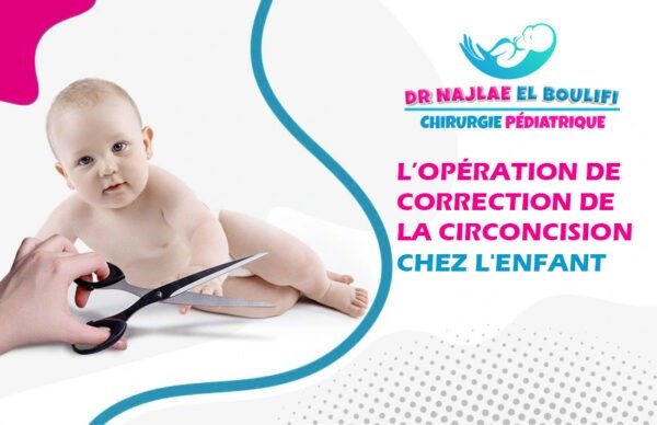 opération de correction de la criconcision chez l'enfant