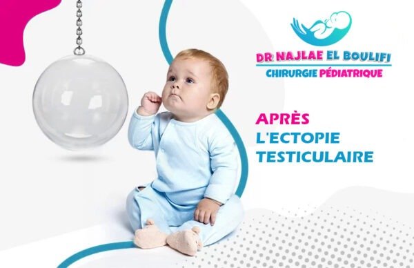 après l'ectopie testiculaire