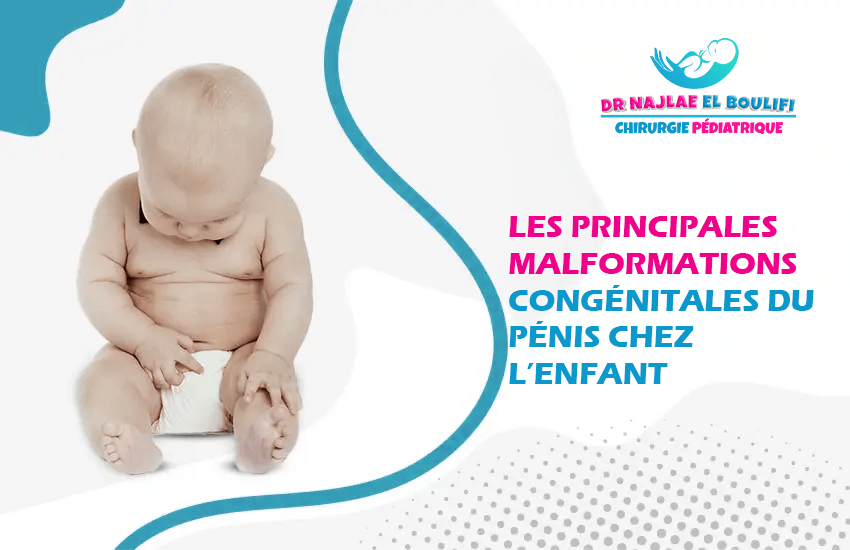 Les principales malformations congénitales du pénis chez l’enfant